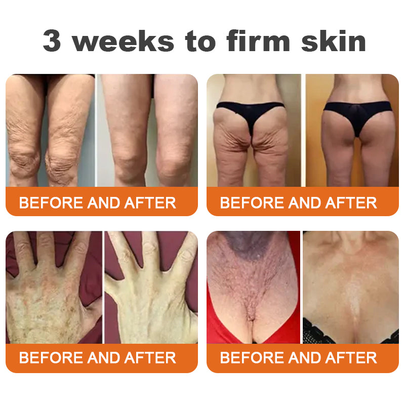 Made and Shipped from USA✨TLOPA® Botox Bee Venom Firming Serum Stick(🔥LAST DAY 70% OFF)🧡🧡