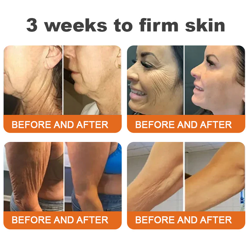 Made and Shipped from USA✨TLOPA® Botox Bee Venom Firming Serum Stick(🔥LAST DAY 70% OFF)🧡🧡